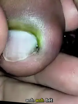 Lấy khoé siêu phê #laykhoe #laykhoemong #laykhoechan #laykhoemongchan #taovamich 