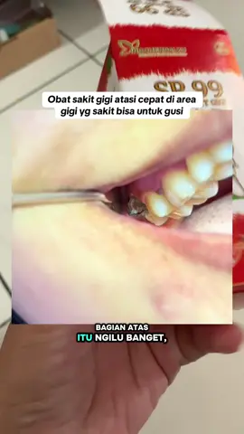 #obatsakitgigi 
