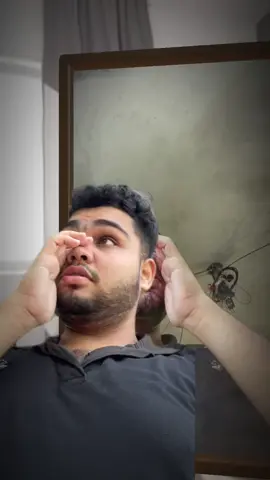 বৃদ্ধ হলে আমি যেরকম দেখতে লাগবো 😕😰 #choruicouple #foryoupage #fypシ #funny #fyp 