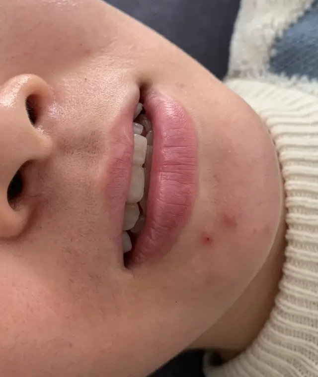 Phun môi tự nhiên