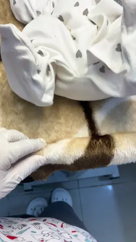 أحلى من يتولد عندي في مناوبتي الليلة #علي  أول مولود للماما 🥹🫶🏻 حاولت إني منديرش شق عجان ولكن لنفيكسيون لي عند الأم خلتني نتضطر نديره لأنه قبل ما يخرج البيبي بدأت التقطعات العشوائية فإلتجأت لتنفيسة خفيفة باش نوسع الطريق للبيبي وما يقطعهاش هو من كل جيهة لأنه الأم كان عندها أنفيكسيون كبيرة، فبالتالي يا حوامل حاولو تعالجو لنفيكسيون (الطياب) لي عندكم سيرتو البكرات راهي تخلف تقطعات كبيرة أثناء الولادة إذا ما عالجتيهاش. وفي الأخير الأم كانت حابة تولد عندي والحمد لله ولدت عندي وكانت في أتم الرضى 🥰 #ريـحـانـة_بـكـوش