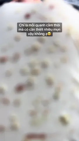 #nặnmunbangtay #nặnmunsiêuphê #ilovetiktok #xuhuong 