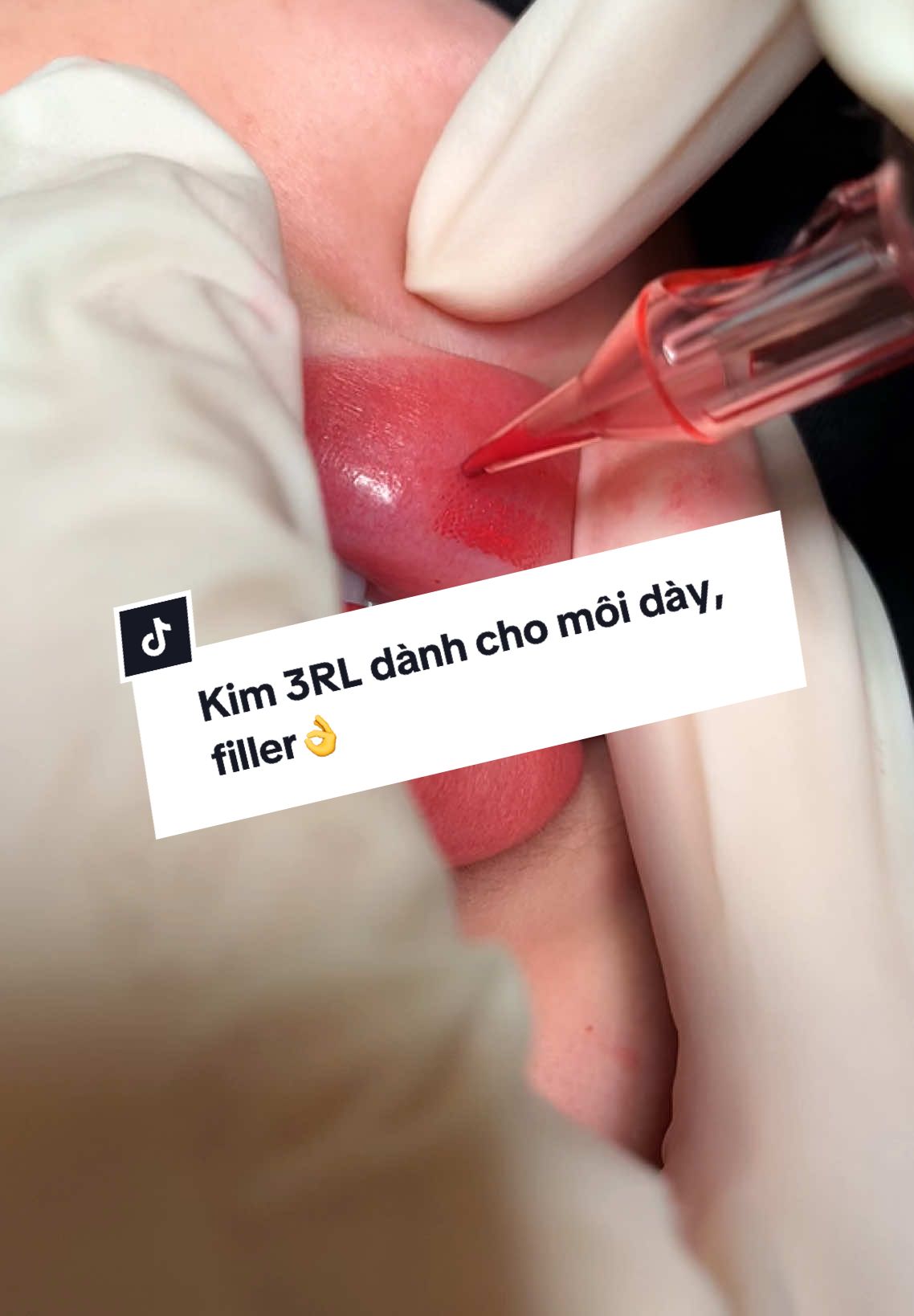 Với 1 khuôn môi dày và còn filler chai cứng, thì chọn kim 3RS, vừa đưa được 1 lượng màu nhiều vào môi 1 lúc, lại vừa rất bén nha cả nhà🥰 #elizabethbeauty #moixinh #lamdep #Sunshinelips #phunmoitunhien #sunshineLips #ilovetiktok 