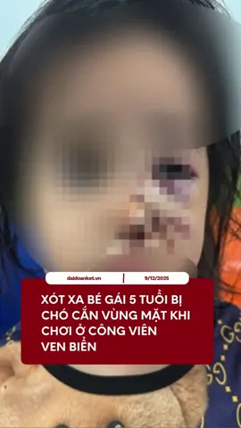 Đang vui chơi tại công viên, bé gái 5 tuổi bất ngờ bị chó lao ra cắn xé vùng mặt, phải chuyển 3 bệnh viện để cấp cứu. #hochiminh #begai #chocan #benhvien #baodaidoanket