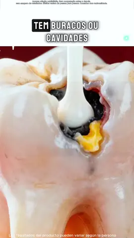 Ter dentes amarelos em 2025 é meio insano 💀 #comédia #xyzbca #viral #fyp #engraçado