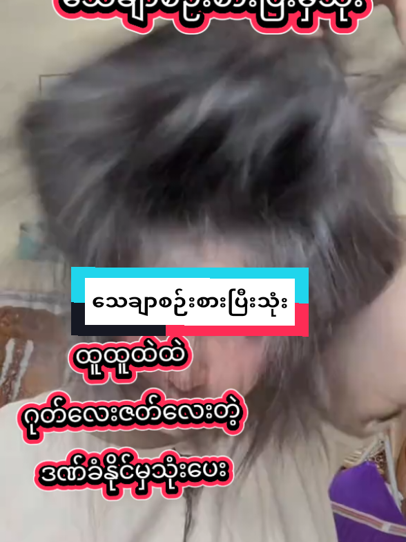 #ထူထူထဲထဲ #ဆံပင်ပြသနာရှိသူတိုင်းကြည့်ပေးပါ #အသစ်ပေါက်အုံထူအရှည်မြန်ချင်ရင်သုံးပေးပါ #တစ်လအတွင်းအုံထူအရှည်မြန်လာစေတဲ့ene @tiktok creators 