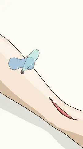 How Anesthesia Actually Works Inside Your Body?