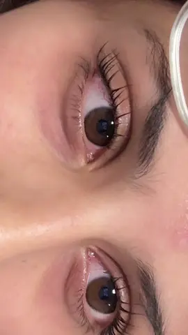 safu nearly blinded me from the amount if solution she put into my eyes