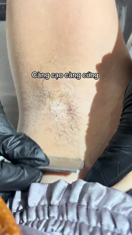 Triệt néc hè đi biển sáng mịn lun #triệt_lông_nách #triệt_lông_bi #Triệt_lông_chân_tay #mayspa 