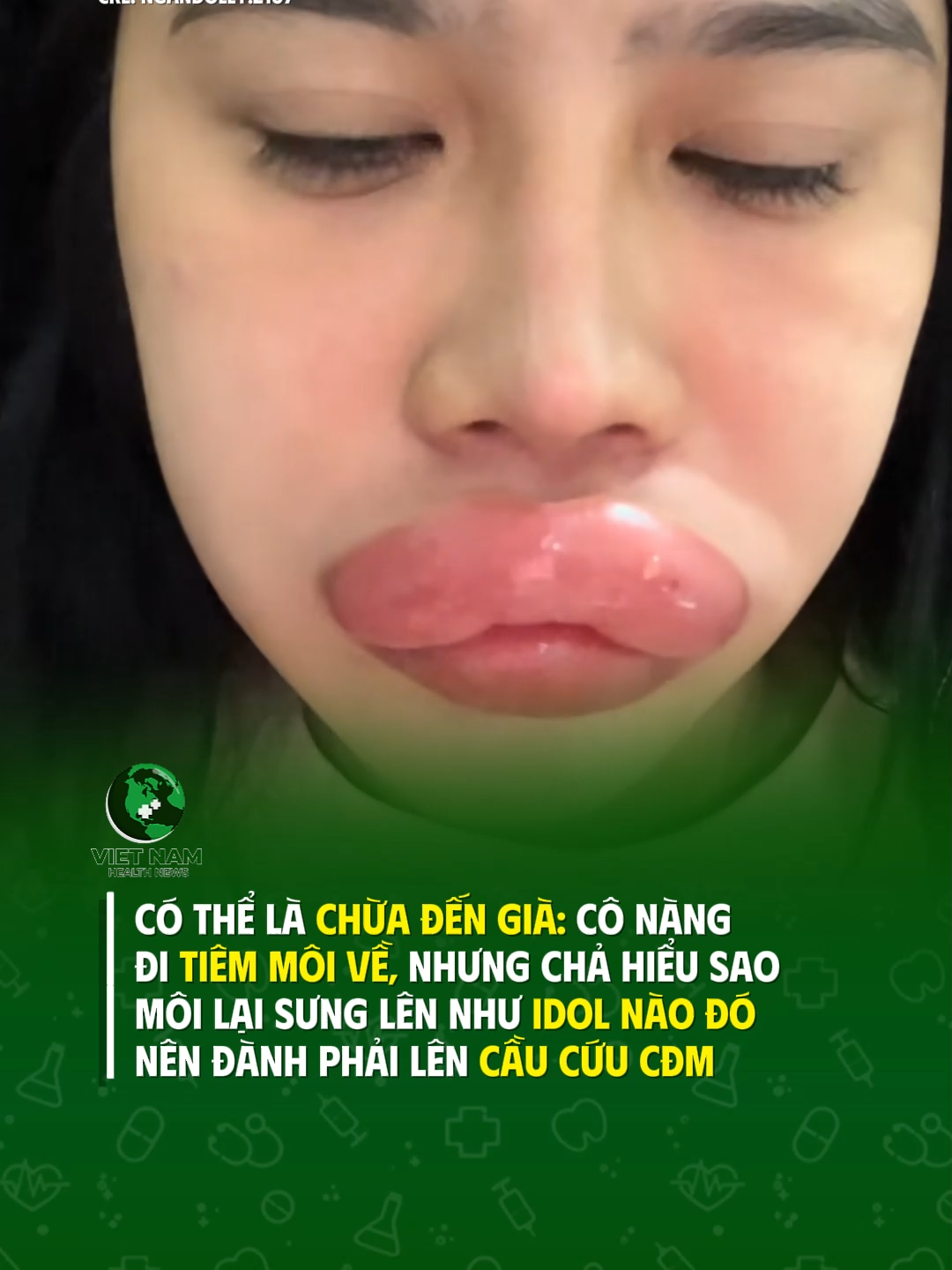 Chừa đến già là có thật =))) #vnhealthnews #tiktoknews