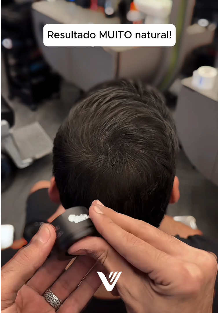 Antes vs depois de respeito! Esse produto é da marca VYON, se você gostou, comenta “eu quero” que eu te envio o link! #calvicie #calvo #cabelo #homem #autoestima    