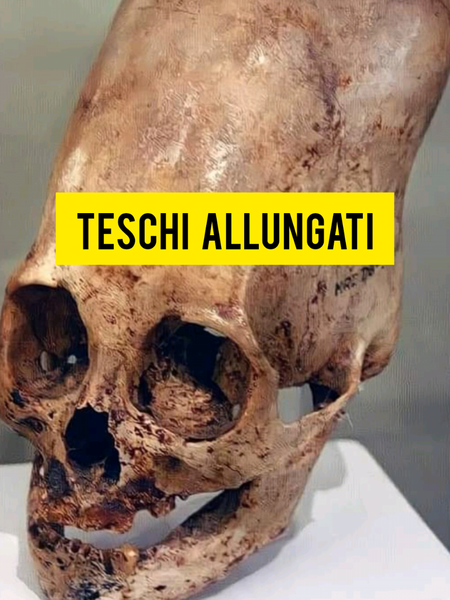 I teschi allungati di Paracas #misteri #archeologia #alieni #segreti 